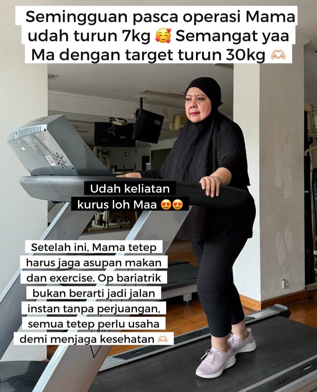 Berat badan ibunda Tasya Kamila turun 7kg seminggu pasca operasi bariatrik dan diet full cairan.